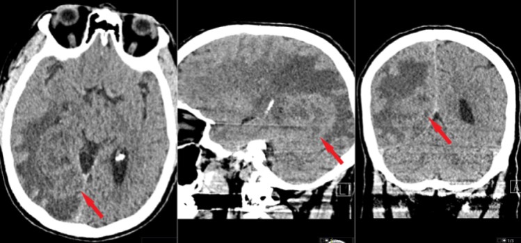 Case image