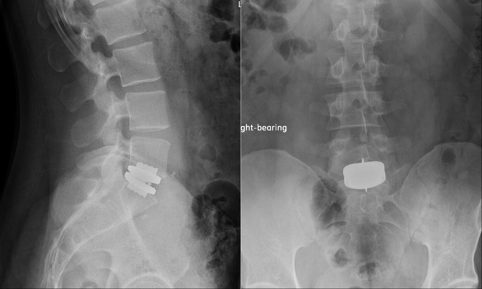 Case image