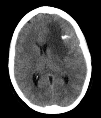 Case image