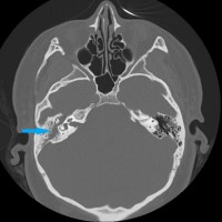 Case image