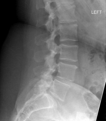 Case image