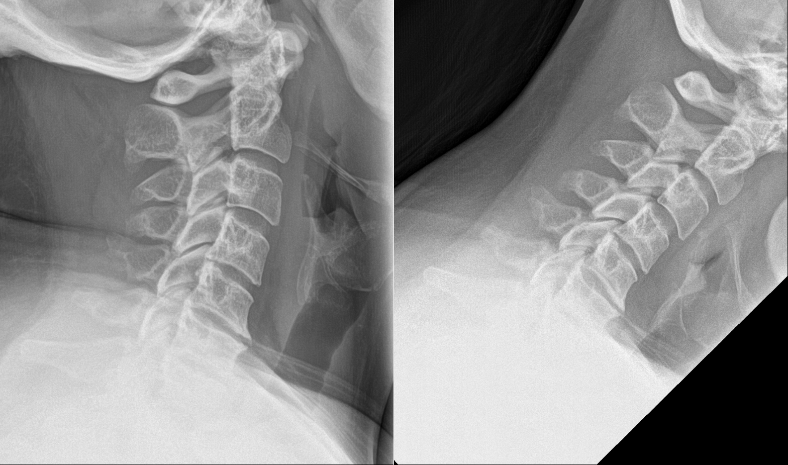 Case image