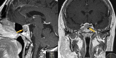 Case image