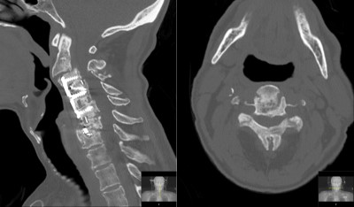 Case image