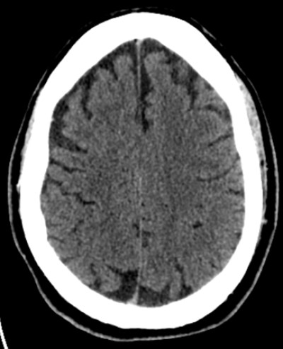 Case image