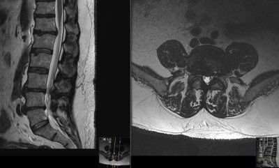 Case image