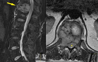 Case image