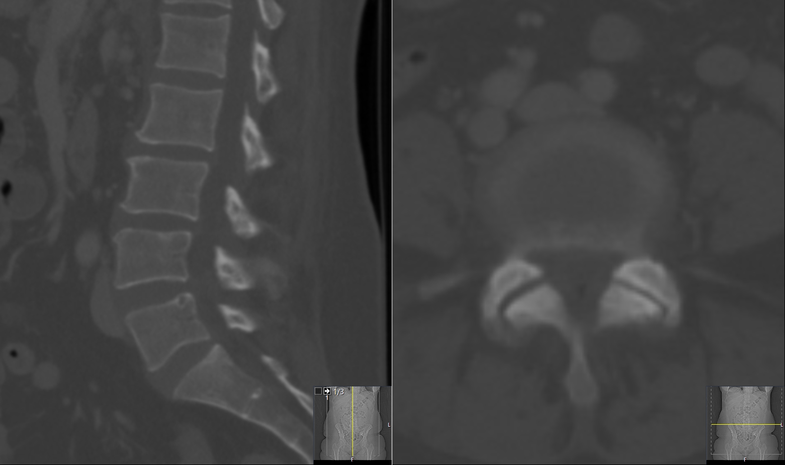 Case image