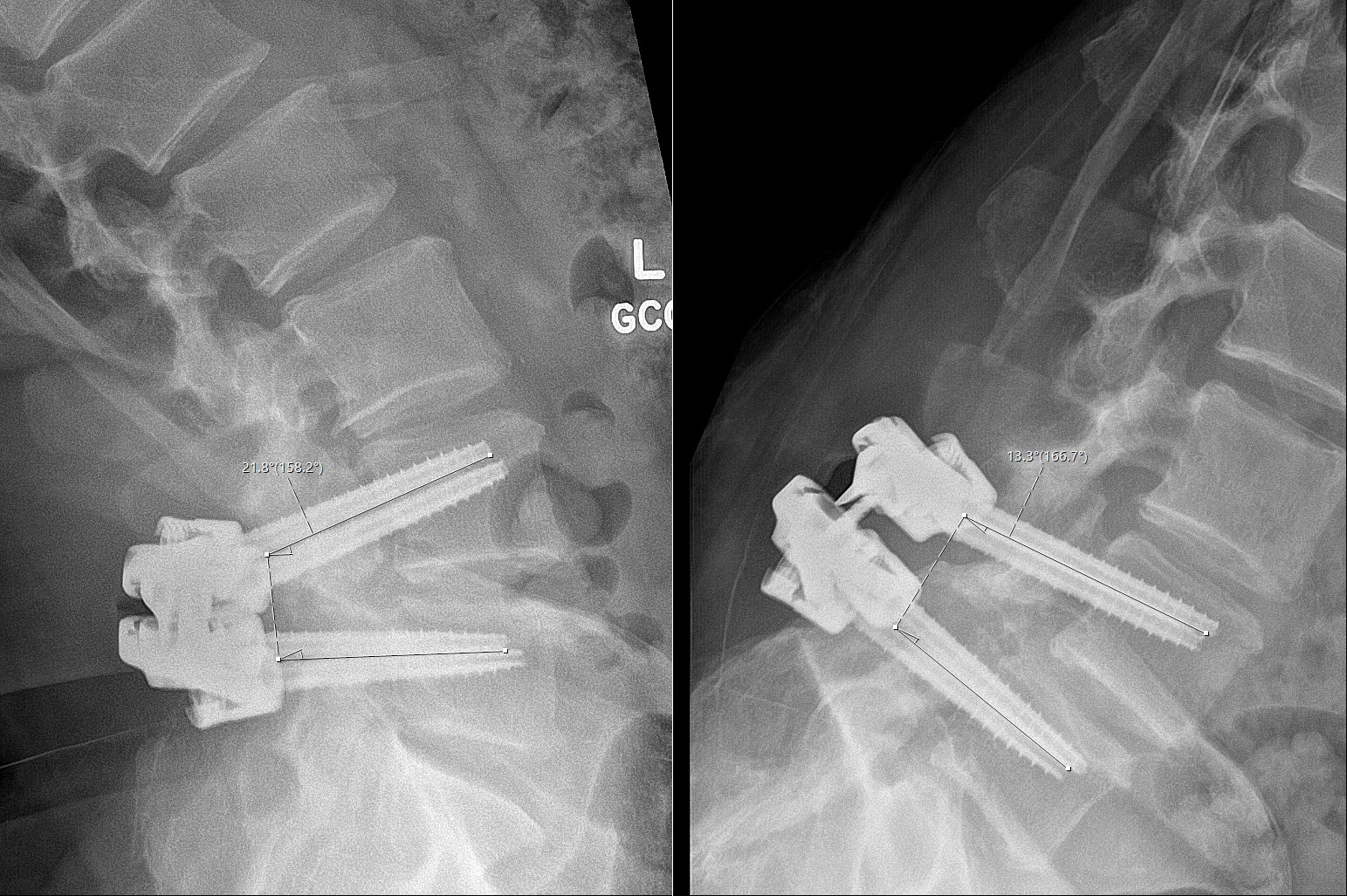 Case image