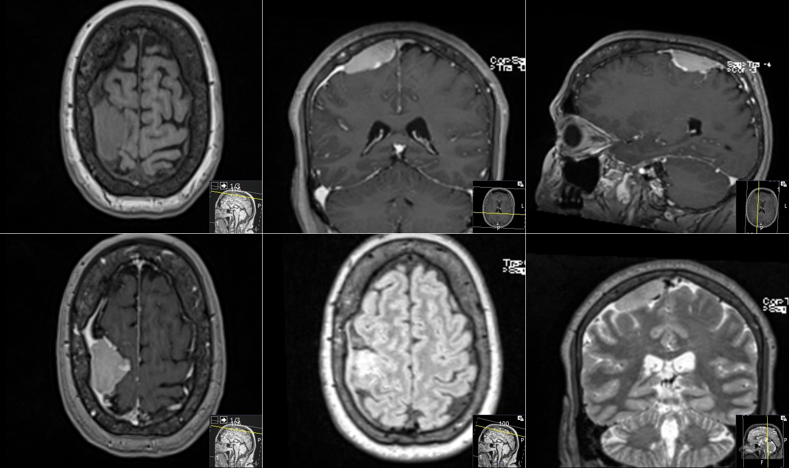 Case image