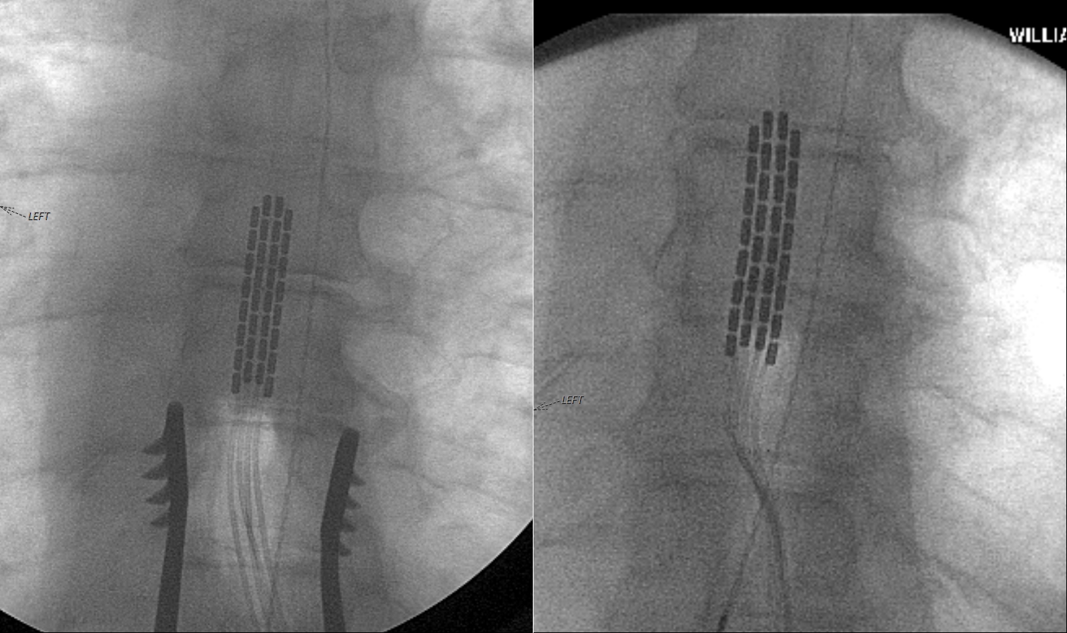 Case image