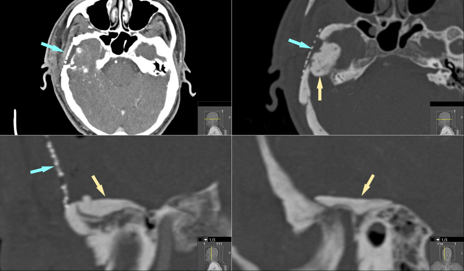 Case image