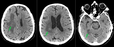 Case image