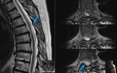 Case image