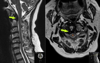 Case image