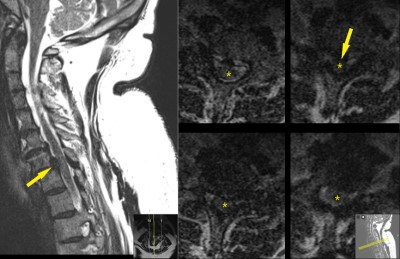 Case image